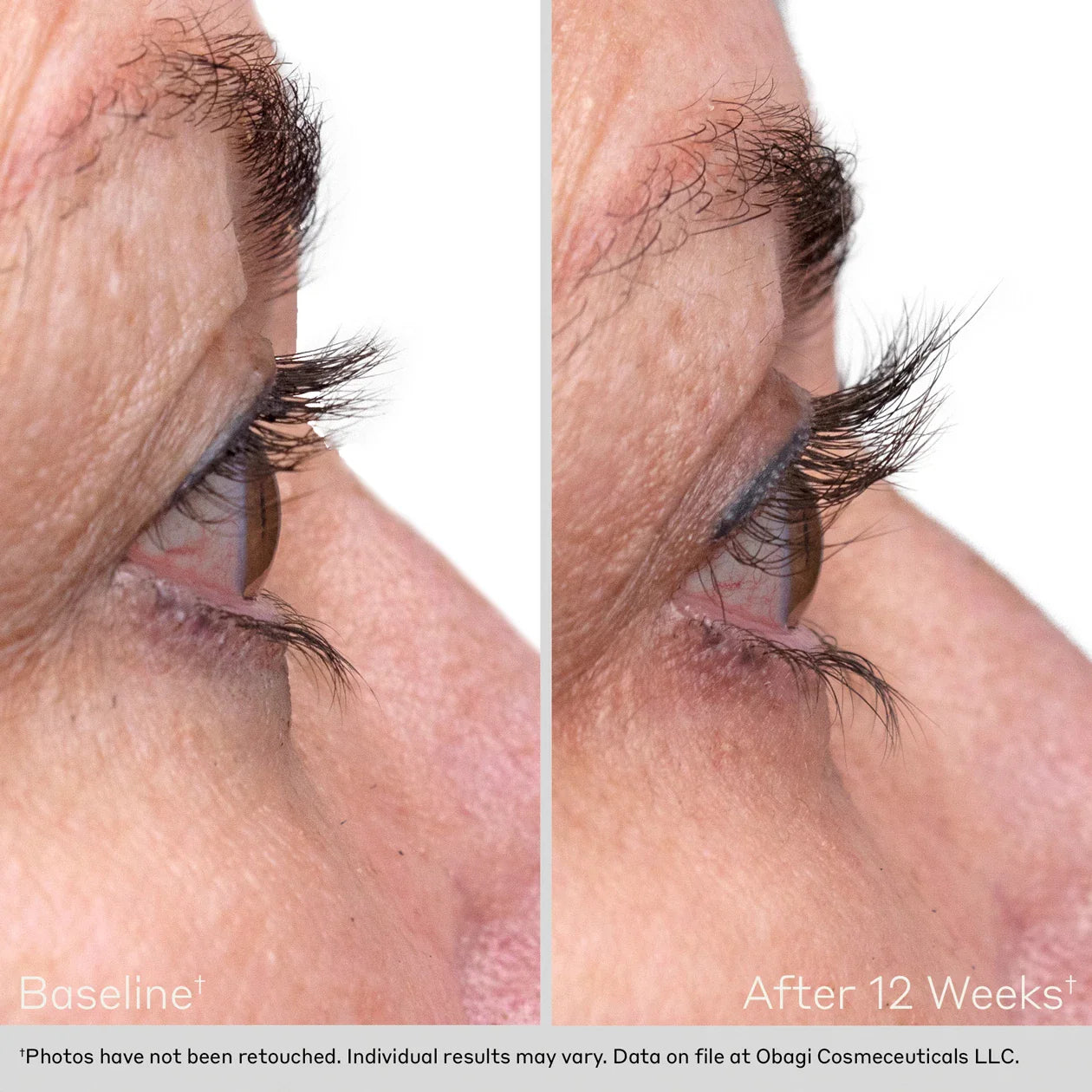 OBAGI LASH BEFORE AFTER