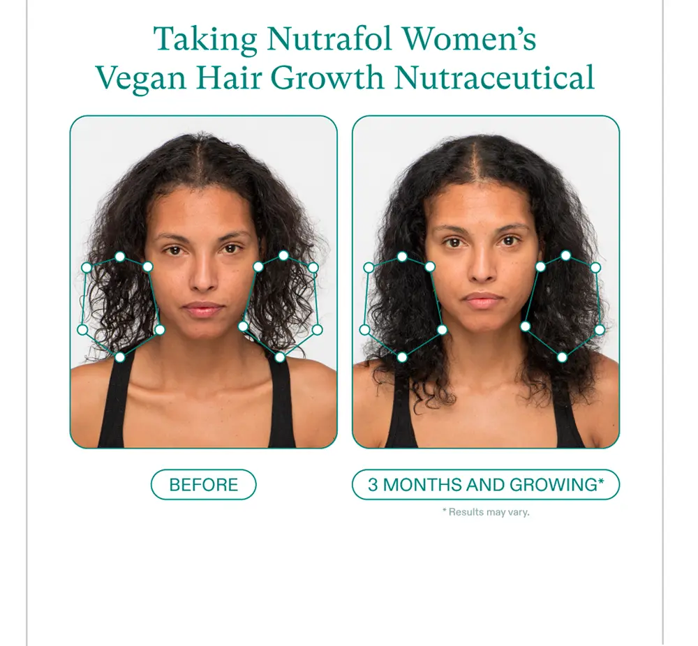 before and after taking nutrafol women;;s vegan hair growth nutraceutical