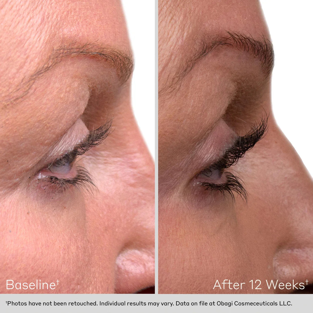 OBAGI LASH BEFORE AFTER
