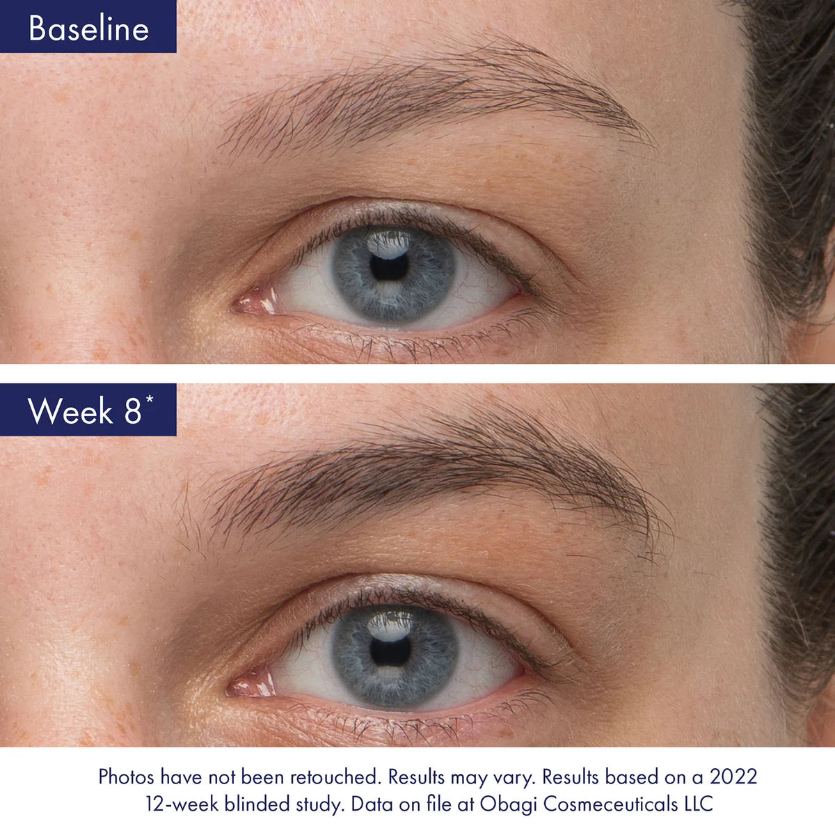 Obagi Nu-Cil Eyebrow Serum Before and After Week 8