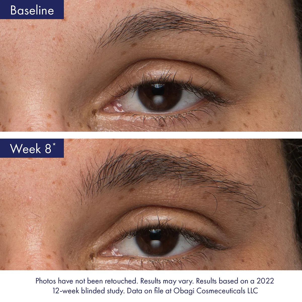 Obagi Nu-Cil Eyebrow Serum Before and After Week 8 2