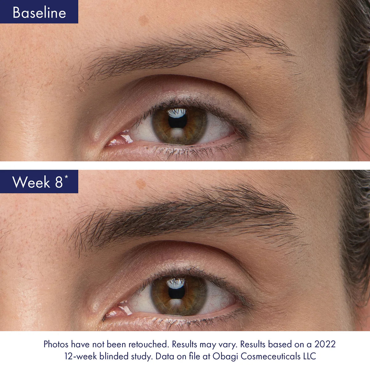 Obagi Nu-Cil Eyebrow Serum Before and After Week 8 3